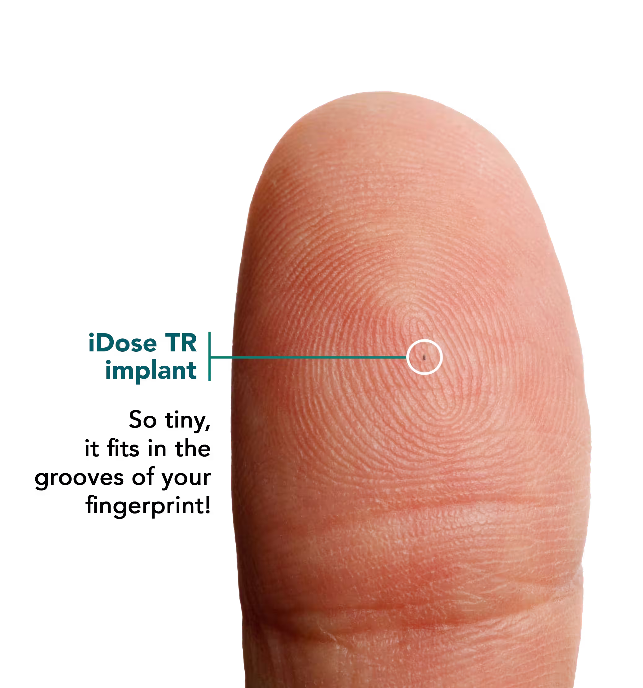 Closeup of fingertip pad with the iDose device shown to scale.